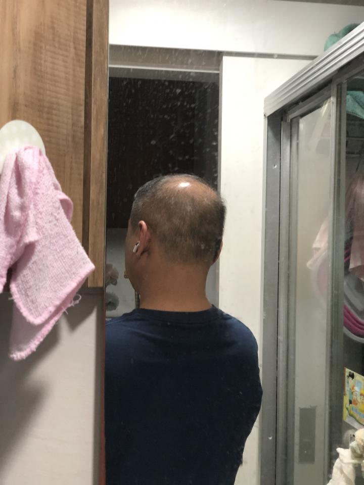 MicrobladingJob photo