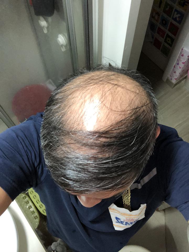 MicrobladingJob photo