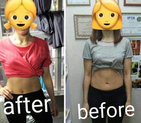 Alice Kong - Before after Alice Kong - Before after