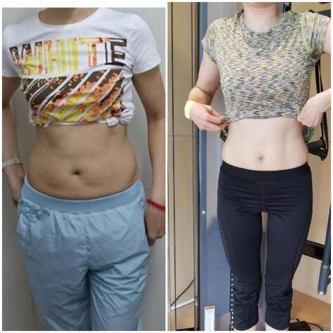 Alice Kong - Before after Alice Kong - Before after