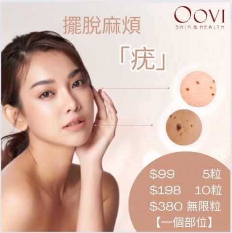 Oovi skin & health - 【疣問題?唔駛驚！】
超抵價??快速K.O“麻煩疣”
【安全無痛，不留痕跡】
治標兼治本，變返滑嫩無瑕肌?

??限時優惠價?
$99 5粒
（不限部位）
$198 10粒
（不限部位）
$380 無限粒
（一個部位無限任脱）

