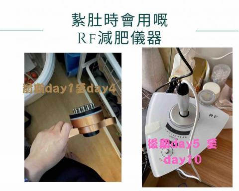 WW Reborn Spot - RF射頻美容針對問題 :
減淡 : 前額紋 , 眼紋 , 魚尾紋 , 虎紋 , 頸紋 , 妊娠紋
提昇 : 眼眉 , 面頰輪廓 , 胸部 , 臀部
收緊 : 眼袋 ,雙下巴, 手臂肉(BYEBYE肉) , 肚腩 , 小腿
修窄 : 角字面(包包面) , 腰間肉(CALL機位)
其他 : 血液循環 ,通淋巴, 肌膚更有彈性, 收細毛孔