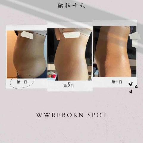 WW Reborn Spot - 盆骨恥骨閉合12大效果：
1. 髖骨與髖骨之間縮小2到8cm
2. 媽媽臀收緊
3. 臀部圓潤緊實飽滿上翹
4. 恥骨提升1到3度
5. 陰道變緊實
6. 盆腔溫度提升1到3度
7. 調理宮寒，改善月經量多量少、提前退後、痛經拖尾的問題
8. 改善盆腔功能性障礙（產後盆腔炎、盆腔積液、尿道炎、附件炎等）
9. 改善產後遺留問題（腰酸腰痛、腰椎間盤突出、便秘、尿頻尿急、遺尿漏尿等）
10. 促進盆腔垃圾惡露毒素的排出
11. 提升夫妻性生活的和諧度
12. 提升卵巢和子宮的機能，延緩更年期7-15年