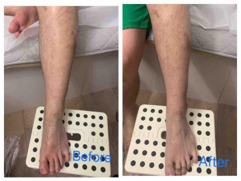 Jessica The Therapy - 客人有膝蓋小腿痛,幫他做了經絡穴位按摩 Jessica The Therapy - 客人有膝蓋小腿痛,幫他做了經絡穴位按摩