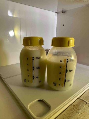 Jessica The Therapy - 客人生完餵哺母乳,但因乳腺閉塞,經過通乳腺,穴位按揉、經絡打通,奶量由100ml增至300ml。 Jessica The Therapy - 客人生完餵哺母乳,但因乳腺閉塞,經過通乳腺,穴位按揉、經絡打通,奶量由100ml增至300ml。