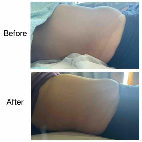 Jessica The Therapy - 客人產後因盆骨前傾,做了盆骨修復和按摩排毒 Jessica The Therapy - 客人產後因盆骨前傾,做了盆骨修復和按摩排毒