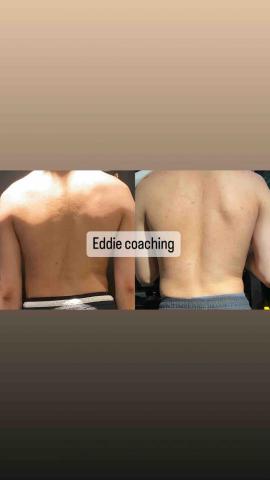 Eddie - 脊柱側彎改善(3星期) Eddie - 脊柱側彎改善(3星期)