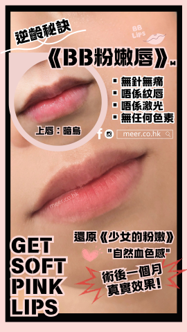 meer.co.hk 紋髮育髮美妝店 - 無創BB粉嫩唇: 無針無痛, 不紋繡, 不激光, 沒色素, 只需做一次, 配合粉嫩霜, 可以持久粉嫩 meer.co.hk 紋髮育髮美妝店 - 無創BB粉嫩唇: 無針無痛, 不紋繡, 不激光, 沒色素, 只需做一次, 配合粉嫩霜, 可以持久粉嫩
