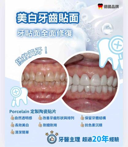 Angel cheung -  poster 