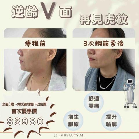 Angel cheung - zpost