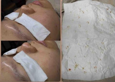 beauty_Fi - 針對油脂，暗蒼，暗粒