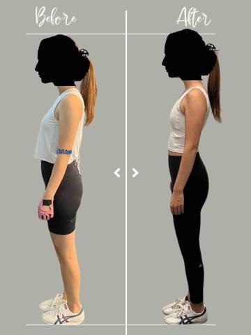 Derek Wong｜專治 Office 痛症・圓肩寒背｜科 - 改善頭前傾及盆骨前傾問題