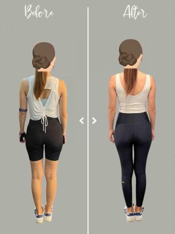 Derek Wong｜專治 Office 痛症・圓肩寒背｜科 - 改善背部線條